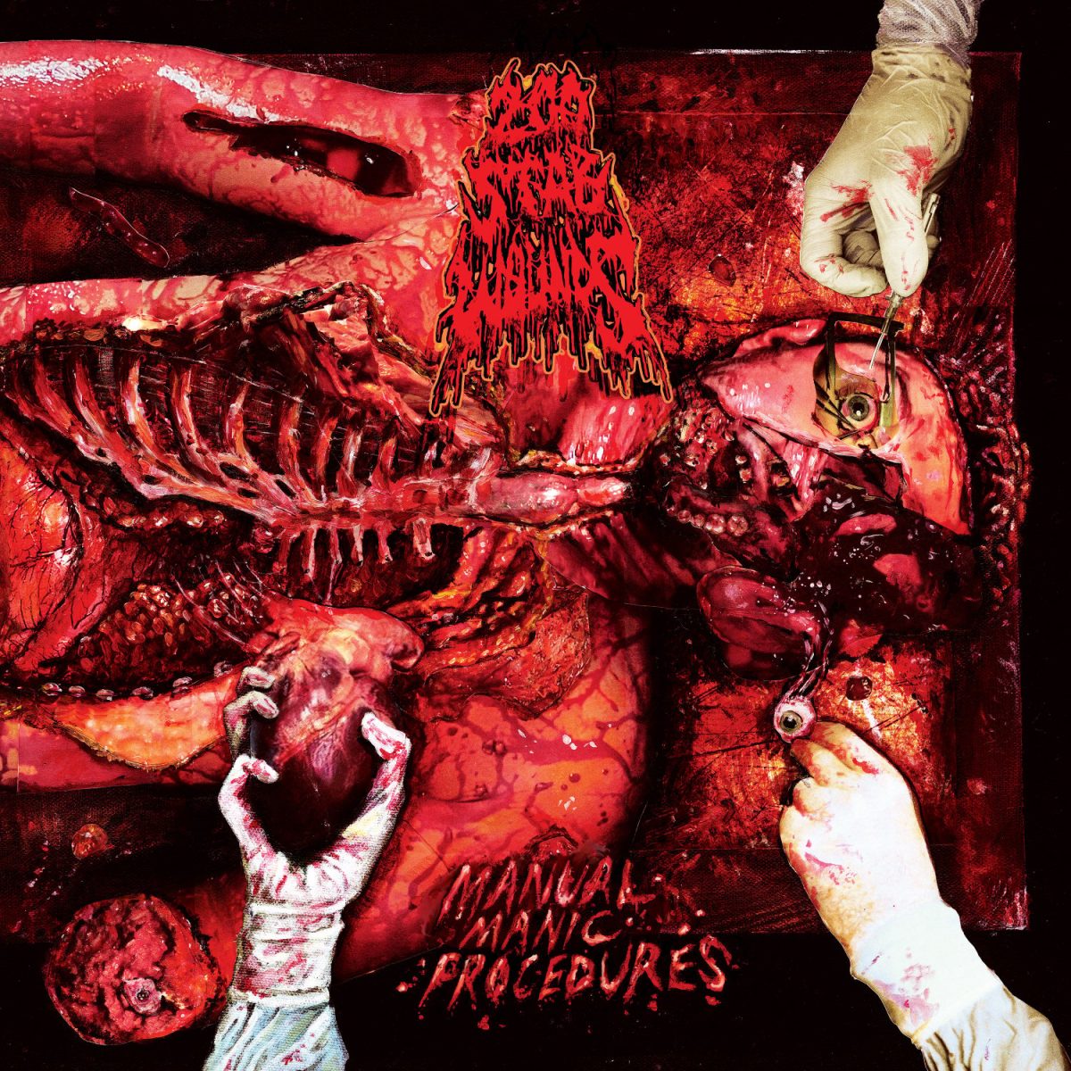 200 Stab Wounds – Manual Manic Procedures